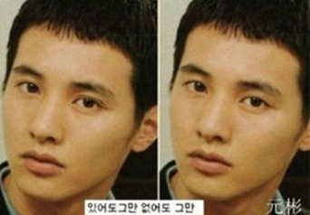 动心了吗？双眼皮手术前后对比图